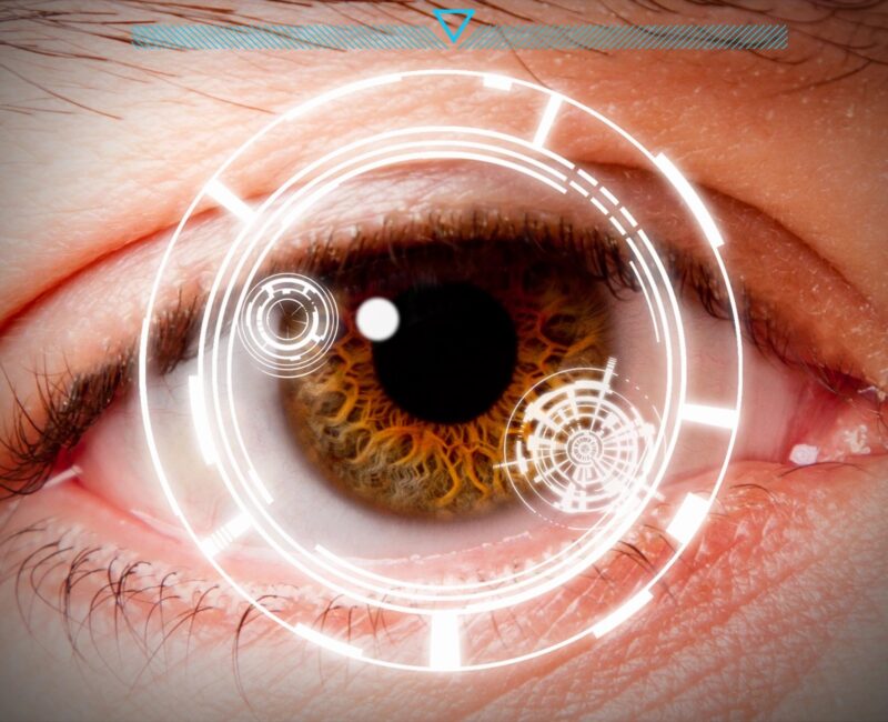 Eye examination