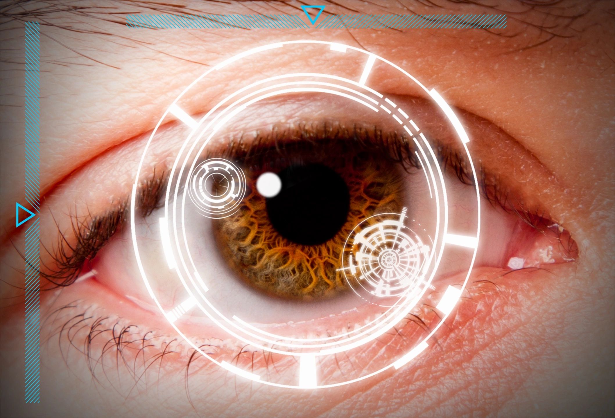 Eye examination